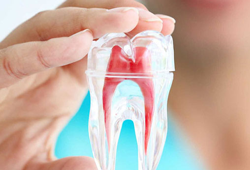 root-canal-queen-creek​