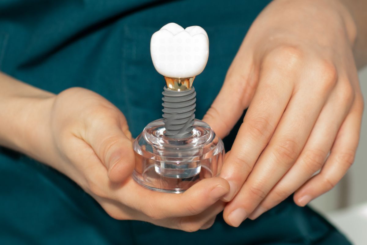 How Long Do Dental Implants Last