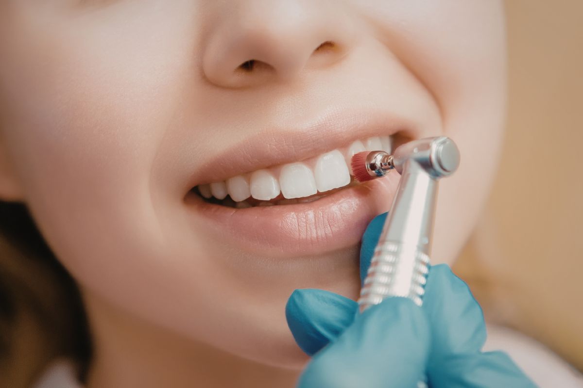 Professional Dental Cleanings